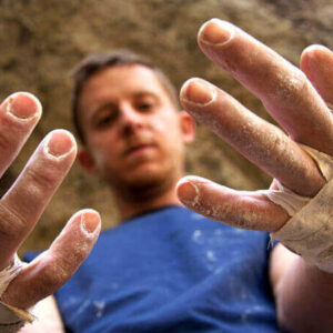 Climber’s Hands: How to Take Care of Calluses & Prevent Flappers