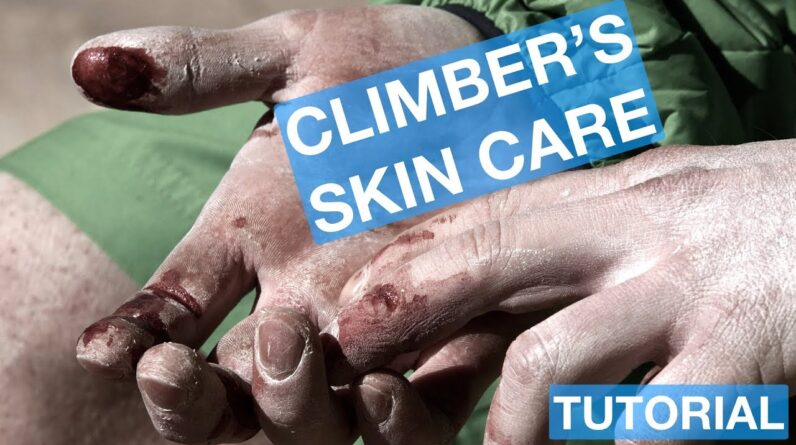 SKIN CARE FOR CLIMBERS | CLIMBING TUTORIAL